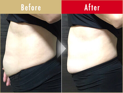 before after 3
