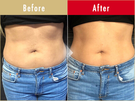 before after 4